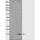 DF6721 at 1/100 staining Mouse brain tissue by IHC-P. The sample was formaldehyde fixed and a heat mediated antigen retrieval step in citrate buffer was performed. The sample was then blocked and incubated with the antibody for 1.5 hours at 22¡ãC. An HRP conjugated goat anti-rabbit antibody was used as the secondary