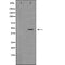 DF6722 at 1/100 staining Human lymph node tissue by IHC-P. The sample was formaldehyde fixed and a heat mediated antigen retrieval step in citrate buffer was performed. The sample was then blocked and incubated with the antibody for 1.5 hours at 22¡ãC. An HRP conjugated goat anti-rabbit antibody was used as the secondary