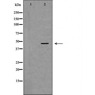 DF6722 at 1/100 staining Human lymph node tissue by IHC-P. The sample was formaldehyde fixed and a heat mediated antigen retrieval step in citrate buffer was performed. The sample was then blocked and incubated with the antibody for 1.5 hours at 22¡ãC. An HRP conjugated goat anti-rabbit antibody was used as the secondary