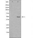 DF6723 at 1/100 staining Rat colon tissue by IHC-P. The sample was formaldehyde fixed and a heat mediated antigen retrieval step in citrate buffer was performed. The sample was then blocked and incubated with the antibody for 1.5 hours at 22¡ãC. An HRP conjugated goat anti-rabbit antibody was used as the secondary