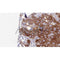 Western blot analysis of extracts from Rat  heart, using TNFRSF14  Antibody. The lane on the left was treated with blocking peptide.