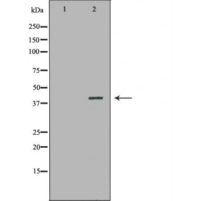 DF6725 at 1/100 staining Mouse liver tissue by IHC-P. The sample was formaldehyde fixed and a heat mediated antigen retrieval step in citrate buffer was performed. The sample was then blocked and incubated with the antibody for 1.5 hours at 22¡ãC. An HRP conjugated goat anti-rabbit antibody was used as the secondary