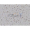 Western blot analysis of extracts from Rat heart, using PLCB1 Antibody. The lane on the left was treated with blocking peptide.