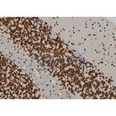 Western blot analysis of extracts from Mouse  brain, using MVP Antibody. The lane on the left was treated with blocking peptide.

Observed bands: 110 kDa.