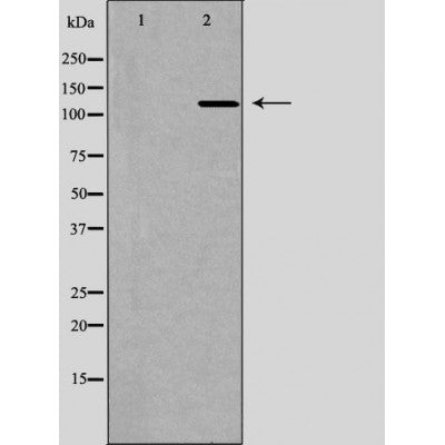 DF6735 at 1/100 staining Human gastric tissue by IHC-P. The sample was formaldehyde fixed and a heat mediated antigen retrieval step in citrate buffer was performed. The sample was then blocked and incubated with the antibody for 1.5 hours at 22¡ãC. An HRP conjugated goat anti-rabbit antibody was used as the secondary