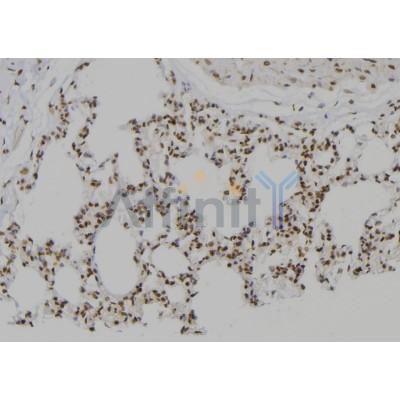 Western blot analysis of extracts from MCF7, using PSMC2 Antibody. The lane on the left was treated with blocking peptide.