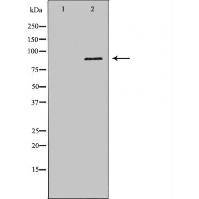 DF6750 at 1/100 staining Mouse brain tissue by IHC-P. The sample was formaldehyde fixed and a heat mediated antigen retrieval step in citrate buffer was performed. The sample was then blocked and incubated with the antibody for 1.5 hours at 22¡ãC. An HRP conjugated goat anti-rabbit antibody was used as the secondary