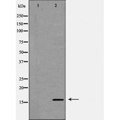 DF6754 at 1/100 staining Human spleen tissue by IHC-P. The sample was formaldehyde fixed and a heat mediated antigen retrieval step in citrate buffer was performed. The sample was then blocked and incubated with the antibody for 1.5 hours at 22¡ãC. An HRP conjugated goat anti-rabbit antibody was used as the secondary