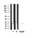 DF6769 at 1/100 staining Mouse lung tissue by IHC-P. The sample was formaldehyde fixed and a heat mediated antigen retrieval step in citrate buffer was performed. The sample was then blocked and incubated with the antibody for 1.5 hours at 22¡ãC. An HRP conjugated goat anti-rabbit antibody was used as the secondary