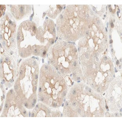 Western blot analysis of extracts from rat spleen, using PCK1 Antibody.