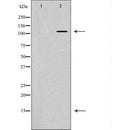 DF6783 at 1/100 staining Mouse muscle tissue by IHC-P. The sample was formaldehyde fixed and a heat mediated antigen retrieval step in citrate buffer was performed. The sample was then blocked and incubated with the antibody for 1.5 hours at 22¡ãC. An HRP conjugated goat anti-rabbit antibody was used as the secondary