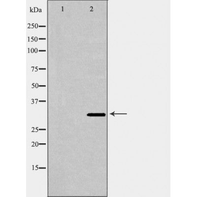DF6784 at 1/100 staining Human prostate tissue by IHC-P. The sample was formaldehyde fixed and a heat mediated antigen retrieval step in citrate buffer was performed. The sample was then blocked and incubated with the antibody for 1.5 hours at 22¡ãC. An HRP conjugated goat anti-rabbit antibody was used as the secondary