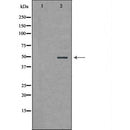 DF6786 at 1/100 staining Mouse kidney tissue by IHC-P. The sample was formaldehyde fixed and a heat mediated antigen retrieval step in citrate buffer was performed. The sample was then blocked and incubated with the antibody for 1.5 hours at 22¡ãC. An HRP conjugated goat anti-rabbit antibody was used as the secondary