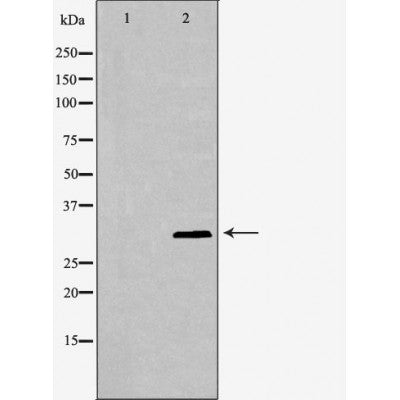 DF6790 staining HepG2 by IF/ICC. The sample were fixed with PFA and permeabilized in 0.1% Triton X-100,then blocked in 10% serum for 45 minutes at 25¡ãC. The primary antibody was diluted at 1/200 and incubated with the sample for 1 hour at 37¡ãC. An  Alexa Fluor 594 conjugated goat anti-rabbit IgG (H+L) Ab, diluted at 1/600, was used as the secondary antibod