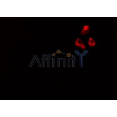 Western blot analysis of extracts from rat lung, using CDKN3 Antibody.