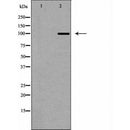 DF6795 at 1/100 staining Mouse muscle tissue by IHC-P. The sample was formaldehyde fixed and a heat mediated antigen retrieval step in citrate buffer was performed. The sample was then blocked and incubated with the antibody for 1.5 hours at 22¡ãC. An HRP conjugated goat anti-rabbit antibody was used as the secondary