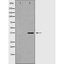 DF6796 at 1/100 staining Mouse liver tissue by IHC-P. The sample was formaldehyde fixed and a heat mediated antigen retrieval step in citrate buffer was performed. The sample was then blocked and incubated with the antibody for 1.5 hours at 22¡ãC. An HRP conjugated goat anti-rabbit antibody was used as the secondary