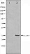 Western blot analysis on A549 cell lysate using Claudin 5 Antibody,The lane on the left is treated with the antigen-specific peptide.