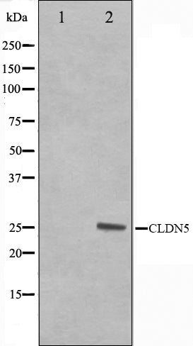 Western blot analysis on A549 cell lysate using Claudin 5 Antibody,The lane on the left is treated with the antigen-specific peptide.