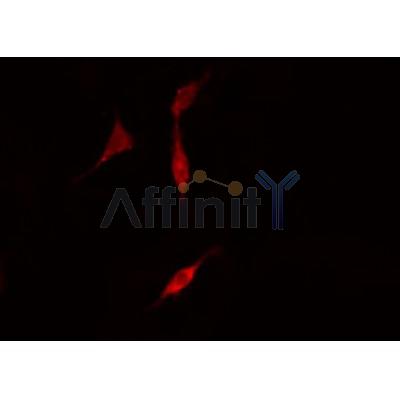 AF0130 staining A549  cells by IF/ICC. The sample were fixed with PFA and permeabilized in 0.1% Triton X-100,then blocked in 10% serum for 45 minutes at 25¡ãC. The primary antibody was diluted at 1/200 and incubated with the sample for 1 hour at 37¡ãC. An  Alexa Fluor 594 conjugated goat anti-rabbit IgG (H+L) antibody(Cat.