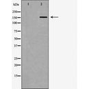 DF6800 at 1/100 staining Rat brain tissue by IHC-P. The sample was formaldehyde fixed and a heat mediated antigen retrieval step in citrate buffer was performed. The sample was then blocked and incubated with the antibody for 1.5 hours at 22¡ãC. An HRP conjugated goat anti-rabbit antibody was used as the secondary