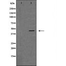 DF6805 at 1/100 staining Human Head and neck cancer tissue by IHC-P. The sample was formaldehyde fixed and a heat mediated antigen retrieval step in citrate buffer was performed. The sample was then blocked and incubated with the antibody for 1.5 hours at 22¡ãC. An HRP conjugated goat anti-rabbit antibody was used as the secondary