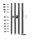 DF6806 at 1/100 staining Mouse kidney tissue by IHC-P. The sample was formaldehyde fixed and a heat mediated antigen retrieval step in citrate buffer was performed. The sample was then blocked and incubated with the antibody for 1.5 hours at 22¡ãC. An HRP conjugated goat anti-rabbit antibody was used as the secondary