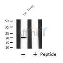Western blot analysis of extracts from rat liver, using IGF2 Antibody.