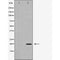 DF6812 at 1/100 staining Human Melanoma tissue by IHC-P. The sample was formaldehyde fixed and a heat mediated antigen retrieval step in citrate buffer was performed. The sample was then blocked and incubated with the antibody for 1.5 hours at 22¡ãC. An HRP conjugated goat anti-rabbit antibody was used as the secondary