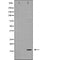 DF6813 at 1/100 staining Human uterus tissue by IHC-P. The sample was formaldehyde fixed and a heat mediated antigen retrieval step in citrate buffer was performed. The sample was then blocked and incubated with the antibody for 1.5 hours at 22¡ãC. An HRP conjugated goat anti-rabbit antibody was used as the secondary