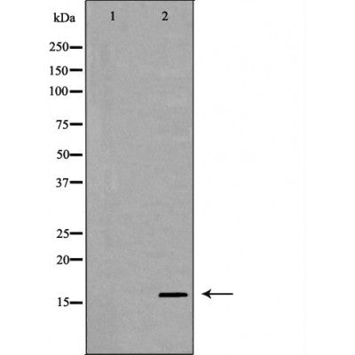 DF6813 at 1/100 staining Human uterus tissue by IHC-P. The sample was formaldehyde fixed and a heat mediated antigen retrieval step in citrate buffer was performed. The sample was then blocked and incubated with the antibody for 1.5 hours at 22¡ãC. An HRP conjugated goat anti-rabbit antibody was used as the secondary