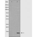 DF6814 at 1/100 staining Human uterus tissue by IHC-P. The sample was formaldehyde fixed and a heat mediated antigen retrieval step in citrate buffer was performed. The sample was then blocked and incubated with the antibody for 1.5 hours at 22¡ãC. An HRP conjugated goat anti-rabbit antibody was used as the secondary