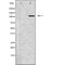 DF6815 at 1/100 staining Human prostate tissue by IHC-P. The sample was formaldehyde fixed and a heat mediated antigen retrieval step in citrate buffer was performed. The sample was then blocked and incubated with the antibody for 1.5 hours at 22¡ãC. An HRP conjugated goat anti-rabbit antibody was used as the secondary