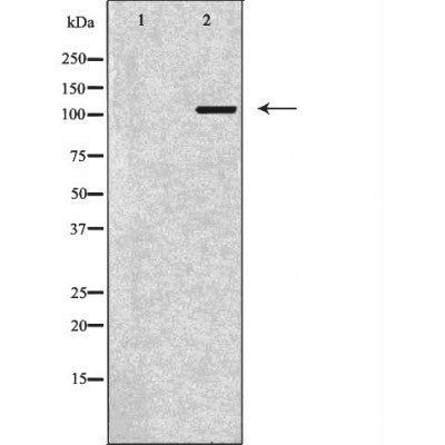 DF6815 at 1/100 staining Human prostate tissue by IHC-P. The sample was formaldehyde fixed and a heat mediated antigen retrieval step in citrate buffer was performed. The sample was then blocked and incubated with the antibody for 1.5 hours at 22¡ãC. An HRP conjugated goat anti-rabbit antibody was used as the secondary