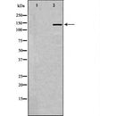 DF6822 at 1/100 staining Human cervical cancer tissue by IHC-P. The sample was formaldehyde fixed and a heat mediated antigen retrieval step in citrate buffer was performed. The sample was then blocked and incubated with the antibody for 1.5 hours at 22¡ãC. An HRP conjugated goat anti-rabbit antibody was used as the secondary