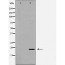 DF6825 at 1/100 staining Human pancreas tissue by IHC-P. The sample was formaldehyde fixed and a heat mediated antigen retrieval step in citrate buffer was performed. The sample was then blocked and incubated with the antibody for 1.5 hours at 22¡ãC. An HRP conjugated goat anti-rabbit antibody was used as the secondary