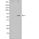 DF6826 at 1/100 staining Human prostate tissue by IHC-P. The sample was formaldehyde fixed and a heat mediated antigen retrieval step in citrate buffer was performed. The sample was then blocked and incubated with the antibody for 1.5 hours at 22¡ãC. An HRP conjugated goat anti-rabbit antibody was used as the secondary