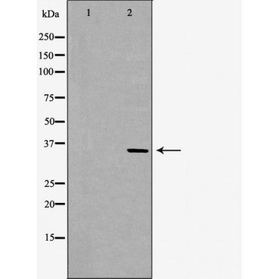 DF6836 at 1/100 staining Mouse kidney tissue by IHC-P. The sample was formaldehyde fixed and a heat mediated antigen retrieval step in citrate buffer was performed. The sample was then blocked and incubated with the antibody for 1.5 hours at 22¡ãC. An HRP conjugated goat anti-rabbit antibody was used as the secondary