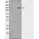 DF6839 at 1/100 staining Human pancreas tissue by IHC-P. The sample was formaldehyde fixed and a heat mediated antigen retrieval step in citrate buffer was performed. The sample was then blocked and incubated with the antibody for 1.5 hours at 22¡ãC. An HRP conjugated goat anti-rabbit antibody was used as the secondary