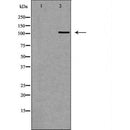 DF6840 at 1/100 staining Rat liver tissue by IHC-P. The sample was formaldehyde fixed and a heat mediated antigen retrieval step in citrate buffer was performed. The sample was then blocked and incubated with the antibody for 1.5 hours at 22¡ãC. An HRP conjugated goat anti-rabbit antibody was used as the secondary