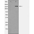 DF6841 at 1/100 staining Mouse colon tissue by IHC-P. The sample was formaldehyde fixed and a heat mediated antigen retrieval step in citrate buffer was performed. The sample was then blocked and incubated with the antibody for 1.5 hours at 22¡ãC. An HRP conjugated goat anti-rabbit antibody was used as the secondary