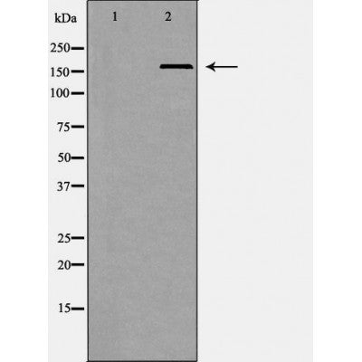 DF6841 at 1/100 staining Mouse colon tissue by IHC-P. The sample was formaldehyde fixed and a heat mediated antigen retrieval step in citrate buffer was performed. The sample was then blocked and incubated with the antibody for 1.5 hours at 22¡ãC. An HRP conjugated goat anti-rabbit antibody was used as the secondary