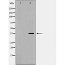 DF6842 at 1/100 staining Mouse kidney tissue by IHC-P. The sample was formaldehyde fixed and a heat mediated antigen retrieval step in citrate buffer was performed. The sample was then blocked and incubated with the antibody for 1.5 hours at 22¡ãC. An HRP conjugated goat anti-rabbit antibody was used as the secondary