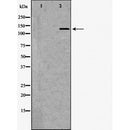 DF6851 at 1/100 staining Rat lung tissue by IHC-P. The sample was formaldehyde fixed and a heat mediated antigen retrieval step in citrate buffer was performed. The sample was then blocked and incubated with the antibody for 1.5 hours at 22¡ãC. An HRP conjugated goat anti-rabbit antibody was used as the secondary