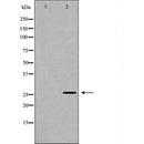 DF6852 at 1/100 staining Rat spleen tissue by IHC-P. The sample was formaldehyde fixed and a heat mediated antigen retrieval step in citrate buffer was performed. The sample was then blocked and incubated with the antibody for 1.5 hours at 22¡ãC. An HRP conjugated goat anti-rabbit antibody was used as the secondary