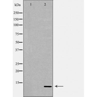 DF6853 at 1/100 staining Rat liver tissue by IHC-P. The sample was formaldehyde fixed and a heat mediated antigen retrieval step in citrate buffer was performed. The sample was then blocked and incubated with the antibody for 1.5 hours at 22¡ãC. An HRP conjugated goat anti-rabbit antibody was used as the secondary