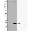 DF6855 at 1/100 staining Mouse liver tissue by IHC-P. The sample was formaldehyde fixed and a heat mediated antigen retrieval step in citrate buffer was performed. The sample was then blocked and incubated with the antibody for 1.5 hours at 22¡ãC. An HRP conjugated goat anti-rabbit antibody was used as the secondary