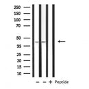 DF6856 at 1/100 staining Human Melanoma tissue by IHC-P. The sample was formaldehyde fixed and a heat mediated antigen retrieval step in citrate buffer was performed. The sample was then blocked and incubated with the antibody for 1.5 hours at 22¡ãC. An HRP conjugated goat anti-rabbit antibody was used as the secondary