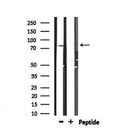 Western blot analysis of extracts from HepG2, using ZYX  Antibody.