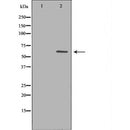 DF6868 at 1/100 staining Mouse colon tissue by IHC-P. The sample was formaldehyde fixed and a heat mediated antigen retrieval step in citrate buffer was performed. The sample was then blocked and incubated with the antibody for 1.5 hours at 22¡ãC. An HRP conjugated goat anti-rabbit antibody was used as the secondary